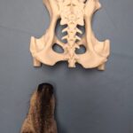 Übergangswirbel und das Lumbo-Sakrale Syndrom®